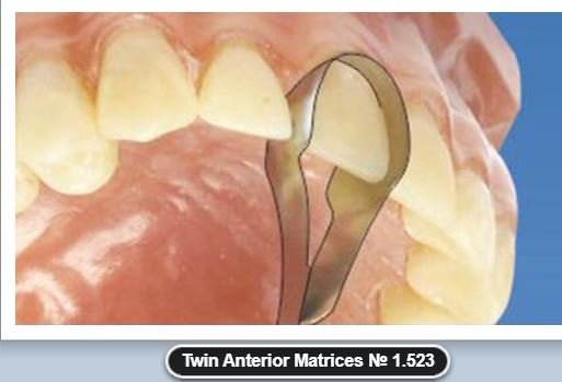 Anterior matrices and strips, matrix strips use, anterior matrix strips, dental products, dental metal matrices, dental products list, dental matrices, metal matrix, dental matrix system, types of matrix bands in dentistry, saddle matrix system, dental products manufacturers in india, types of matrix in dentistry, dental products types, dental products companies in india, use of matrix band in dentistry, buy dental products online, dental product brands, dental saddle contoured metal matrices, dental products uses, dental restorative products, classification of matrices in dentistry, dental matrix band types, dental matrices and wedges